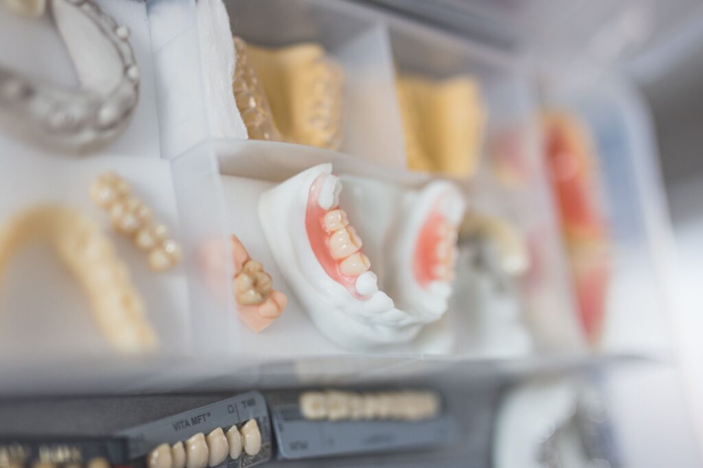 Distintos tipos de prótesis dentales expuestas sobre una mesa en clínica odontológica